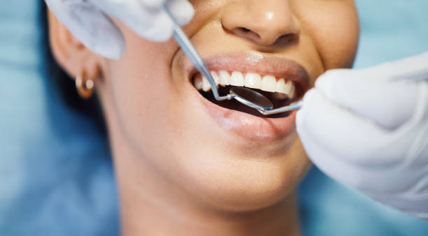 Best Dentist for Tooth Abscess  in Callahan, FL
