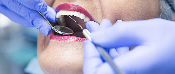 Best Dentist for Tooth Abscess  in Callahan, FL